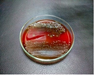 Petri Dish